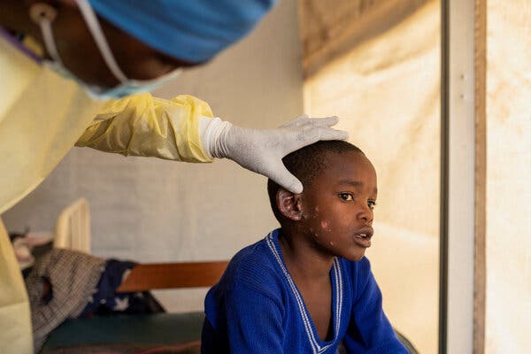 A doctor in yellow protective gear and white gloves examines the head of a young boy in a makeshift tent. 